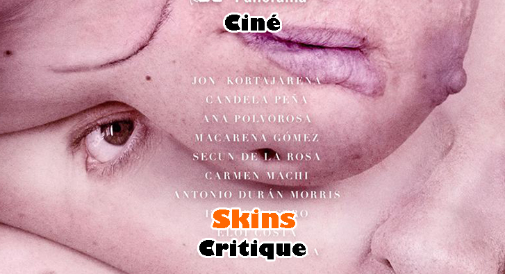 Skins
